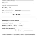 Tb Test Form Fill Online Printable Fillable Blank PdfFiller